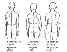 Congenital deformities of the neck and chest